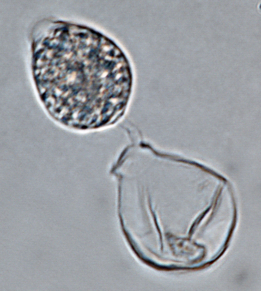   Phytophthora heveae nbsp;(P10167, selected specimen) asexual phase: sporangium with external proliferation; photonbsp;by Gloria Abad, USDA-APHIS-PPQ. 
